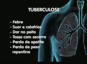 TUBERCULOSE