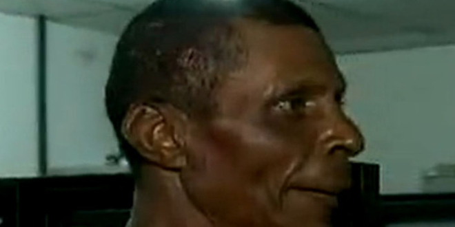 Homem leva pedrada na cabeça após disputa por pipa em Periperi - Foto: Reprodução