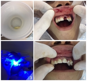 trauma_face_foto_ascom_saude_salvador